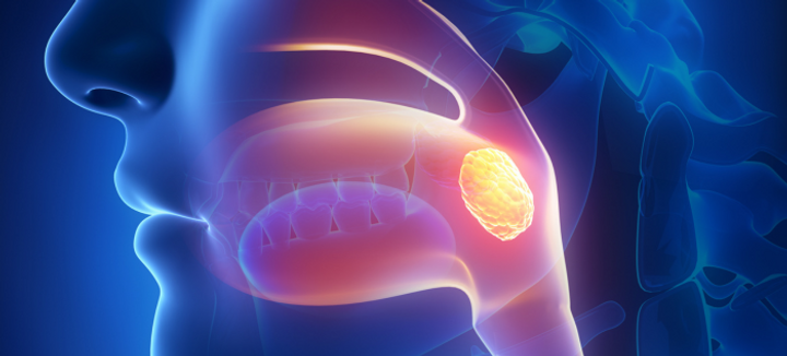 Vectorized x-ray of the tonsils in a lateral view.