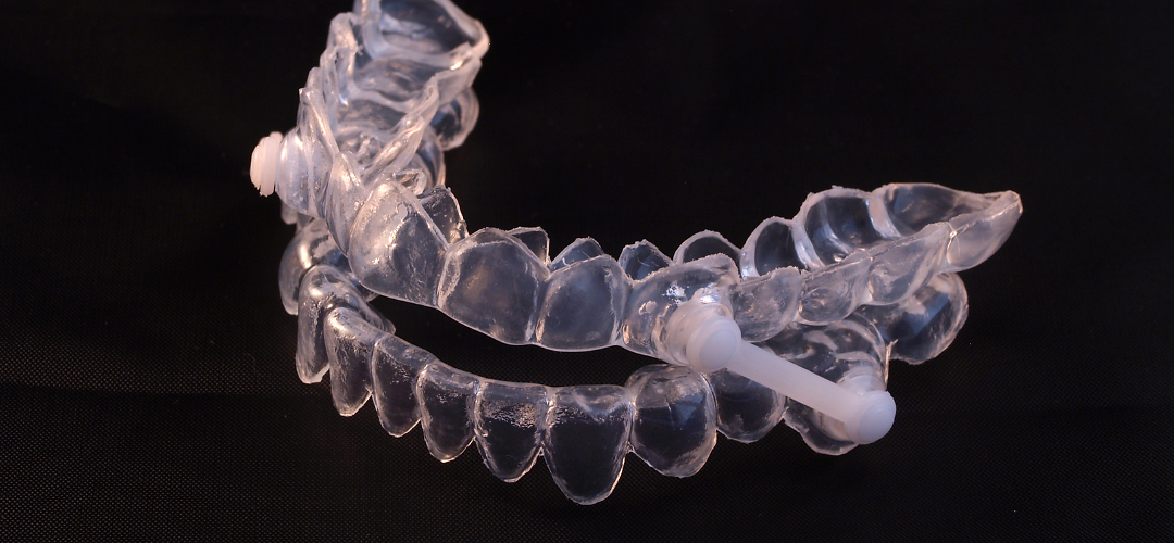  Oral appliance for management of jaws during sleep apnea