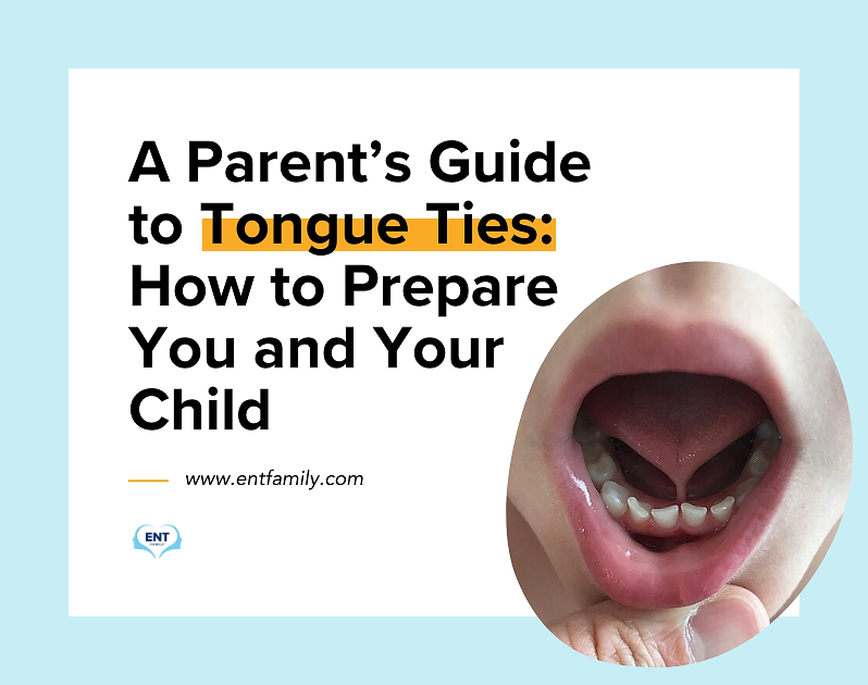 tongue tie guide