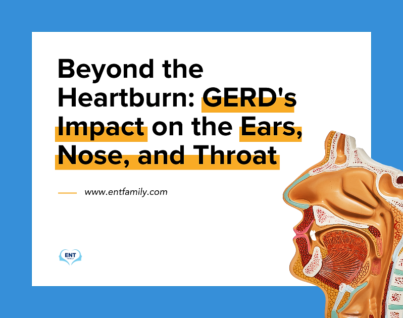 Beyond the Heartburn: GERD's Impact on the Ears, Nose, and Throat